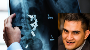 Galette des rois Luxembourg, kings cake